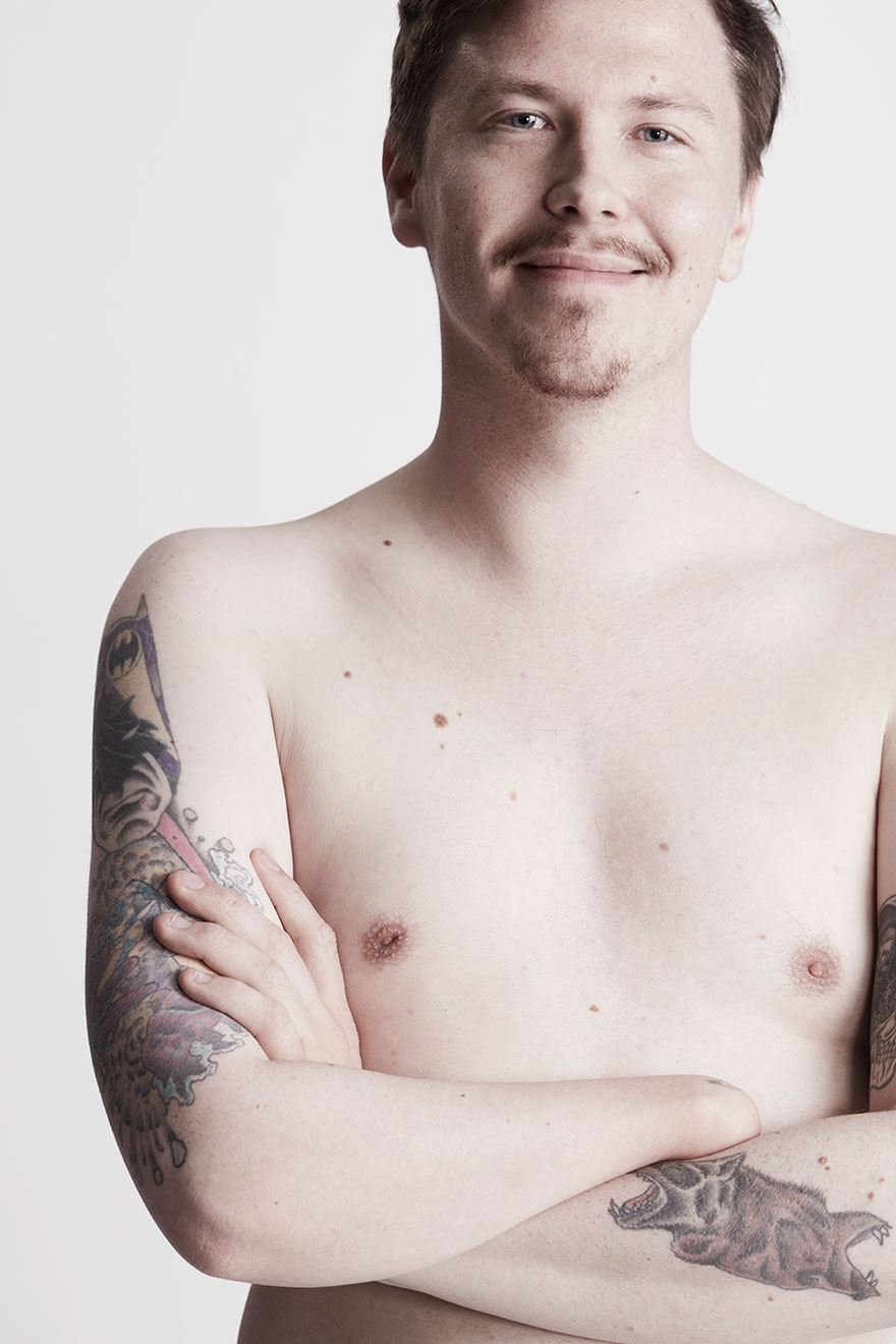 We Photographed 19 People With Limb Differences Aged From 2 To 54 In Body Confidence Shoot