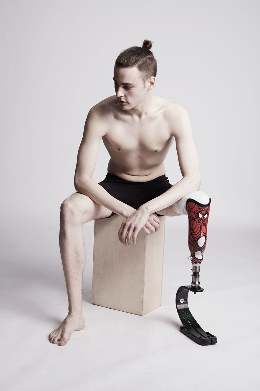 We Photographed 19 People With Limb Differences Aged From 2 To 54 In Body Confidence Shoot