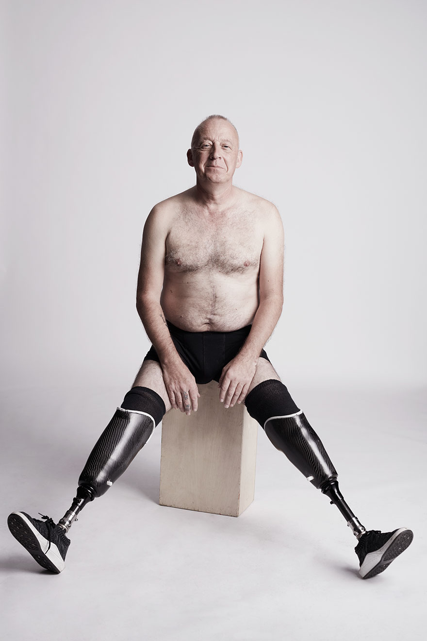 We Photographed 19 People With Limb Differences Aged From 2 To 54 In Body Confidence Shoot