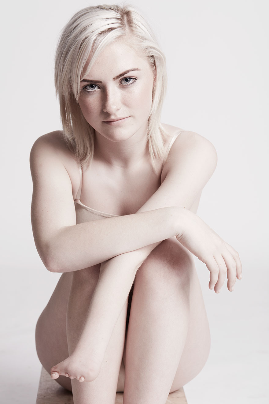 We Photographed 19 People With Limb Differences Aged From 2 To 54 In Body Confidence Shoot