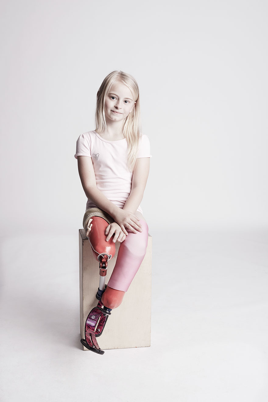 We Photographed 19 People With Limb Differences Aged From 2 To 54 In Body Confidence Shoot We Photographed 19 People With Limb Differences Aged From 2 To 54 In Body Confidence Shoot