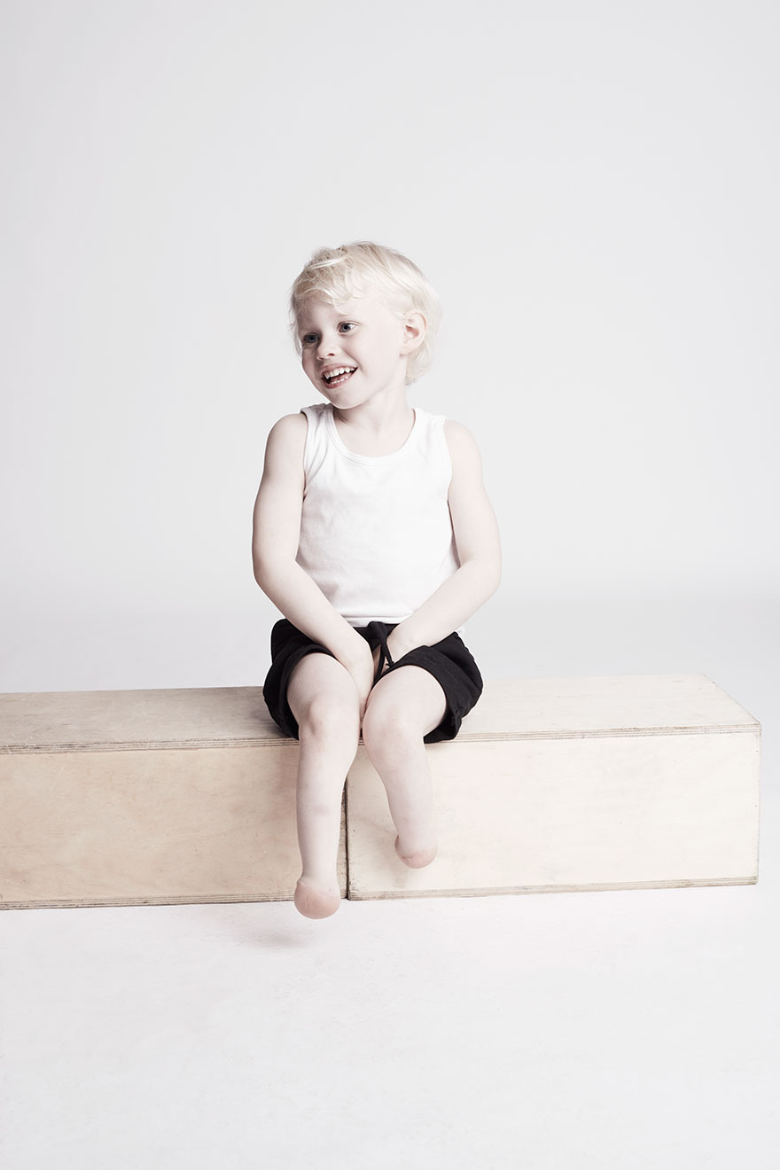 We Photographed 19 People With Limb Differences Aged From 2 To 54 In Body Confidence Shoot We Photographed 19 People With Limb Differences Aged From 2 To 54 In Body Confidence Shoot