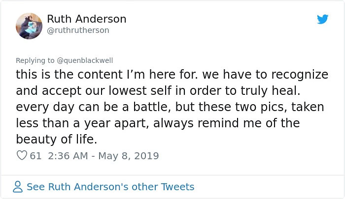 Teen Shows The Difference Mental Health Glow Up Made To Her Appearance, Inspires Others To Post Their Pics Teen Shows The Difference Mental Health Glow Up Made To Her Appearance, Inspires Others To Post Their Pics