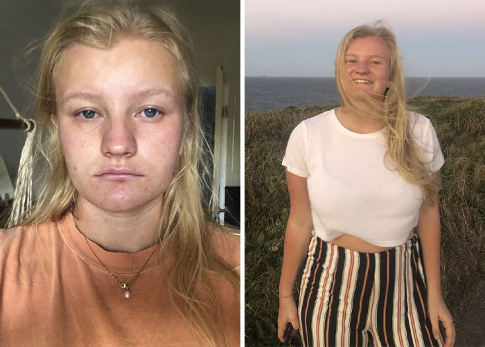 Teen Shows The Difference Mental Health Glow Up Made To Her Appearance, Inspires Others To Post Their Pics Teen Shows The Difference Mental Health Glow Up Made To Her Appearance, Inspires Others To Post Their Pics