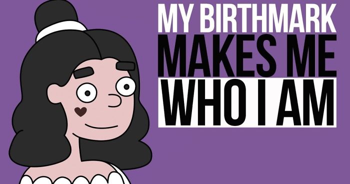 I Have An ‘Ugly’ Birthmark On My Face