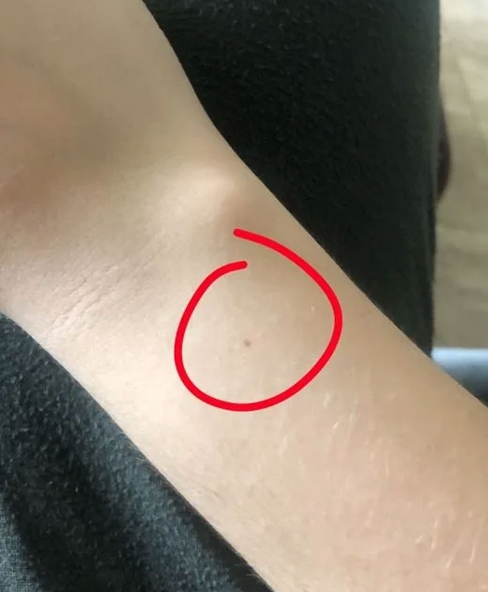 Someone Claims All Women Have A Freckle In The Middle Of Their Wrists, And People Start Freaking Out (23 Pics) Someone Claims All Women Have A Freckle In The Middle Of Their Wrists, And People Start Freaking Out (23 Pics)