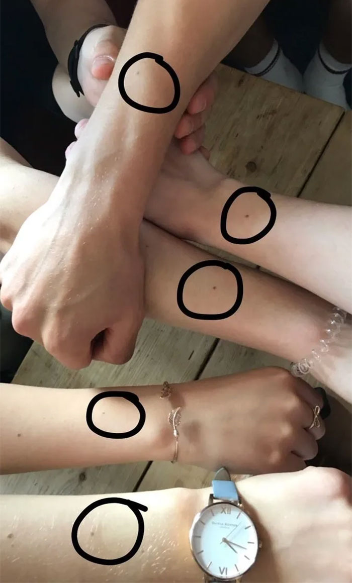 Someone Claims All Women Have A Freckle In The Middle Of Their Wrists, And People Start Freaking Out (23 Pics) Someone Claims All Women Have A Freckle In The Middle Of Their Wrists, And People Start Freaking Out (23 Pics)