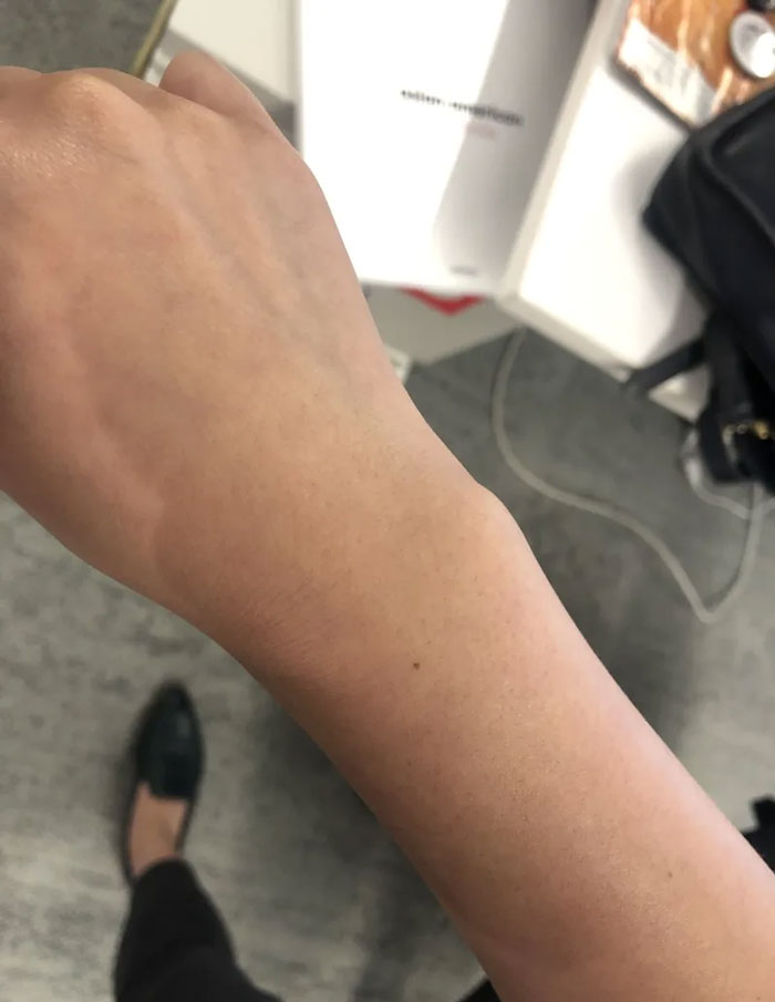 Someone Claims All Women Have A Freckle In The Middle Of Their Wrists, And People Start Freaking Out (23 Pics) Someone Claims All Women Have A Freckle In The Middle Of Their Wrists, And People Start Freaking Out (23 Pics)