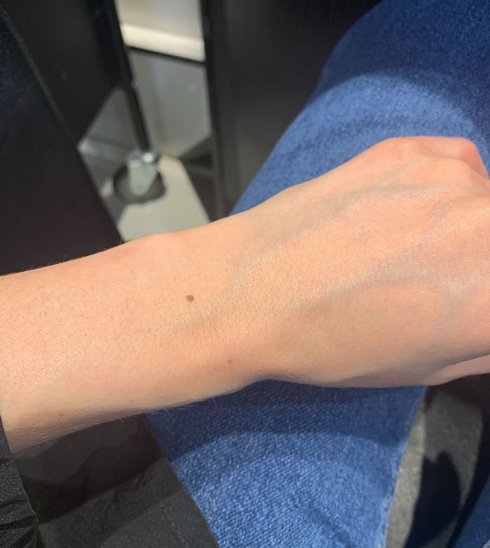 Someone Claims All Women Have A Freckle In The Middle Of Their Wrists, And People Start Freaking Out (23 Pics) Someone Claims All Women Have A Freckle In The Middle Of Their Wrists, And People Start Freaking Out (23 Pics)