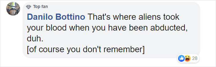 Someone Claims All Women Have A Freckle In The Middle Of Their Wrists, And People Start Freaking Out (23 Pics)