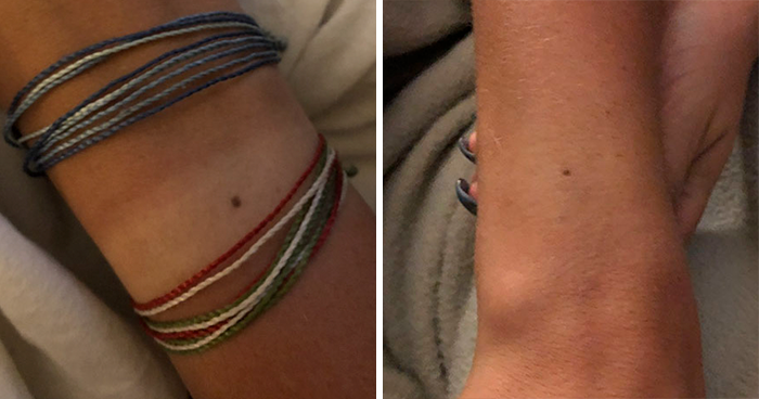 Someone Claims All Women Have A Freckle In The Middle Of Their Wrists, And People Start Freaking Out (23 Pics)