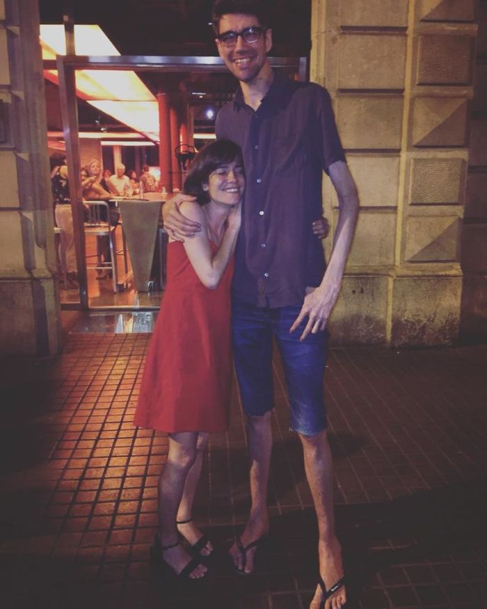 This Man Has A Rare Genetic Condition Which Made Him One Of The Most Sought After Actors In Horror