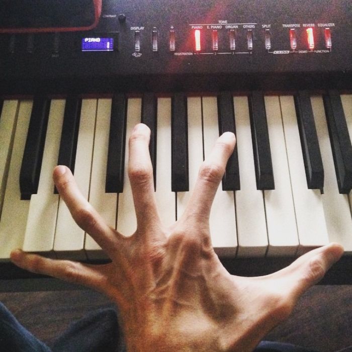 This Man Has A Rare Genetic Condition Which Made Him One Of The Most Sought After Actors In Horror