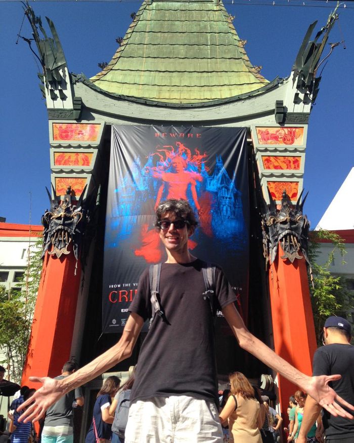 This Man Has A Rare Genetic Condition Which Made Him One Of The Most Sought After Actors In Horror This Man Has A Rare Genetic Condition Which Made Him One Of The Most Sought After Actors In Horror