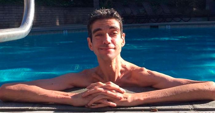 This Man Has A Rare Genetic Condition Which Made Him One Of The Most Sought After Actors In Horror