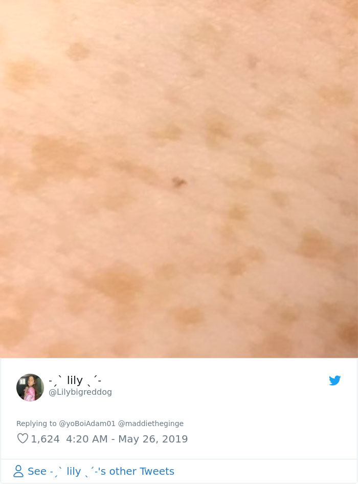 Someone Claims All Women Have A Freckle In The Middle Of Their Wrists, And People Start Freaking Out (23 Pics) Someone Claims All Women Have A Freckle In The Middle Of Their Wrists, And People Start Freaking Out (23 Pics)