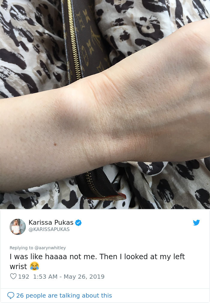 Someone Claims All Women Have A Freckle In The Middle Of Their Wrists, And People Start Freaking Out (23 Pics) Someone Claims All Women Have A Freckle In The Middle Of Their Wrists, And People Start Freaking Out (23 Pics)