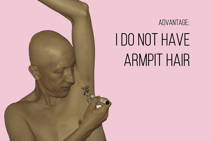 I've Been Living With Alopecia Universalis For 19 Years And I Show The Good And Bad Parts Of It (23 Pics) I've Been Living With Alopecia Universalis For 19 Years And I Show The Good And Bad Parts Of It (23 Pics)