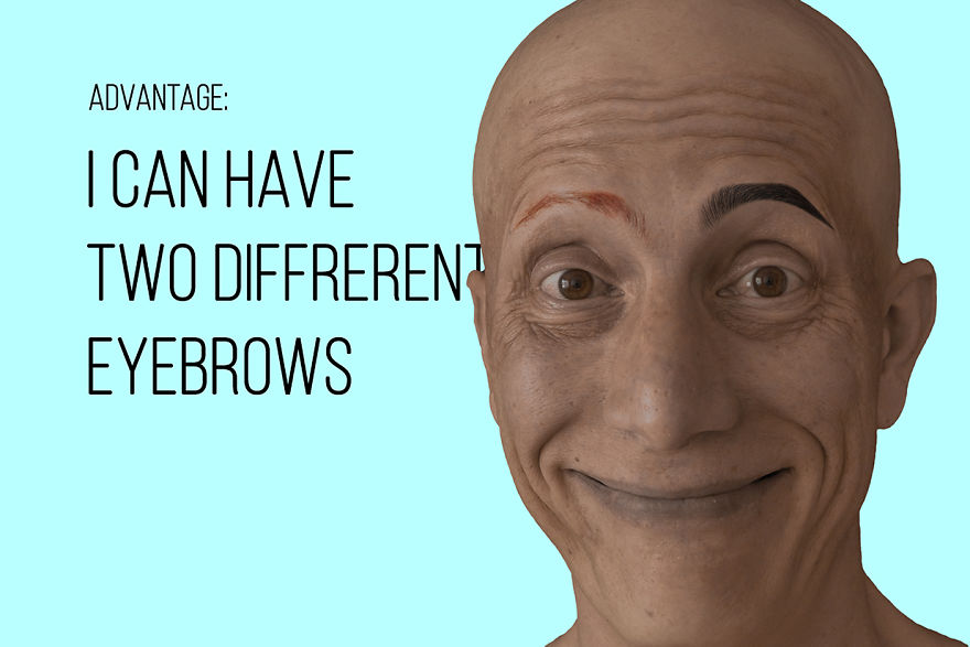 I've Been Living With Alopecia Universalis For 19 Years And I Show The Good And Bad Parts Of It (23 Pics) I've Been Living With Alopecia Universalis For 19 Years And I Show The Good And Bad Parts Of It (23 Pics)