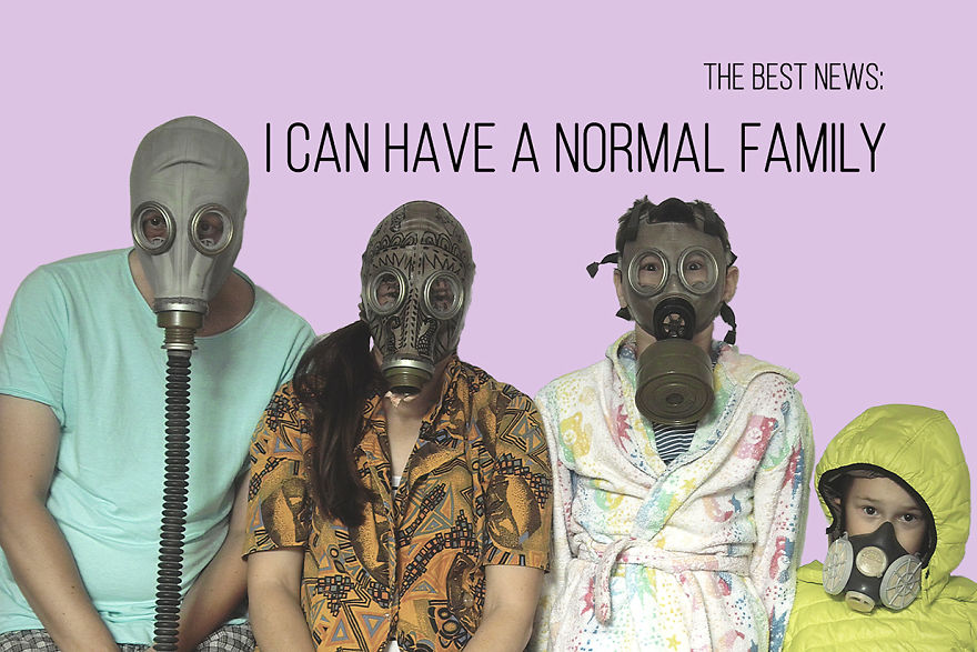 I've Been Living With Alopecia Universalis For 19 Years And I Show The Good And Bad Parts Of It (23 Pics)