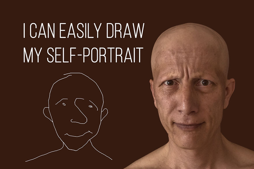 I've Been Living With Alopecia Universalis For 19 Years And I Show The Good And Bad Parts Of It (23 Pics)