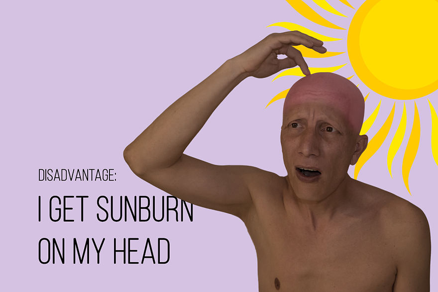 I've Been Living With Alopecia Universalis For 19 Years And I Show The Good And Bad Parts Of It (23 Pics) I've Been Living With Alopecia Universalis For 19 Years And I Show The Good And Bad Parts Of It (23 Pics)