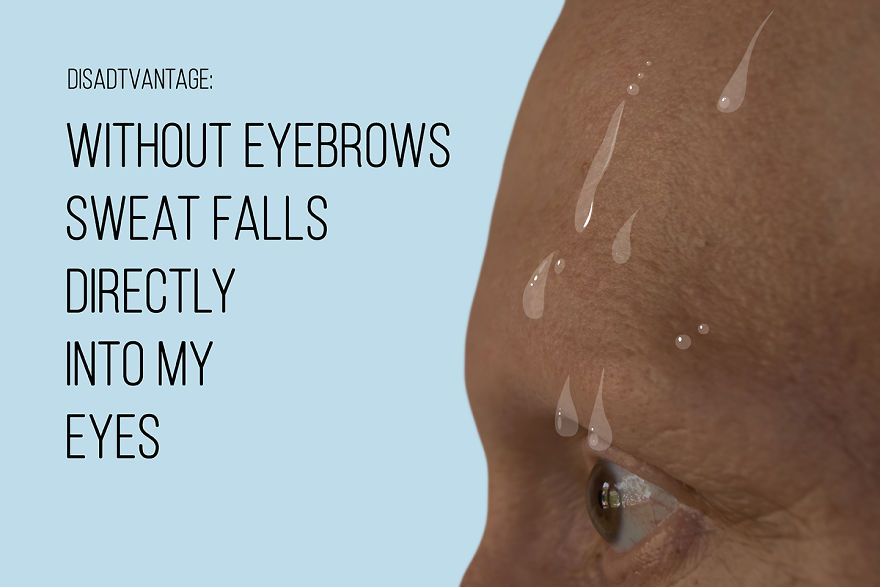 I've Been Living With Alopecia Universalis For 19 Years And I Show The Good And Bad Parts Of It (23 Pics)