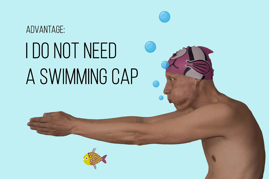 I've Been Living With Alopecia Universalis For 19 Years And I Show The Good And Bad Parts Of It (23 Pics) I've Been Living With Alopecia Universalis For 19 Years And I Show The Good And Bad Parts Of It (23 Pics)