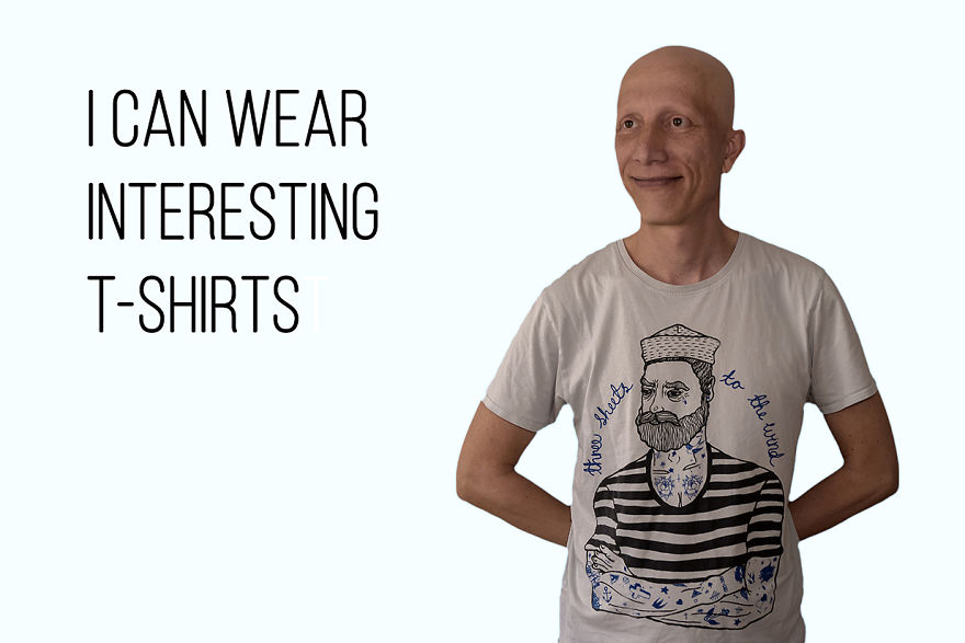 I've Been Living With Alopecia Universalis For 19 Years And I Show The Good And Bad Parts Of It (23 Pics)