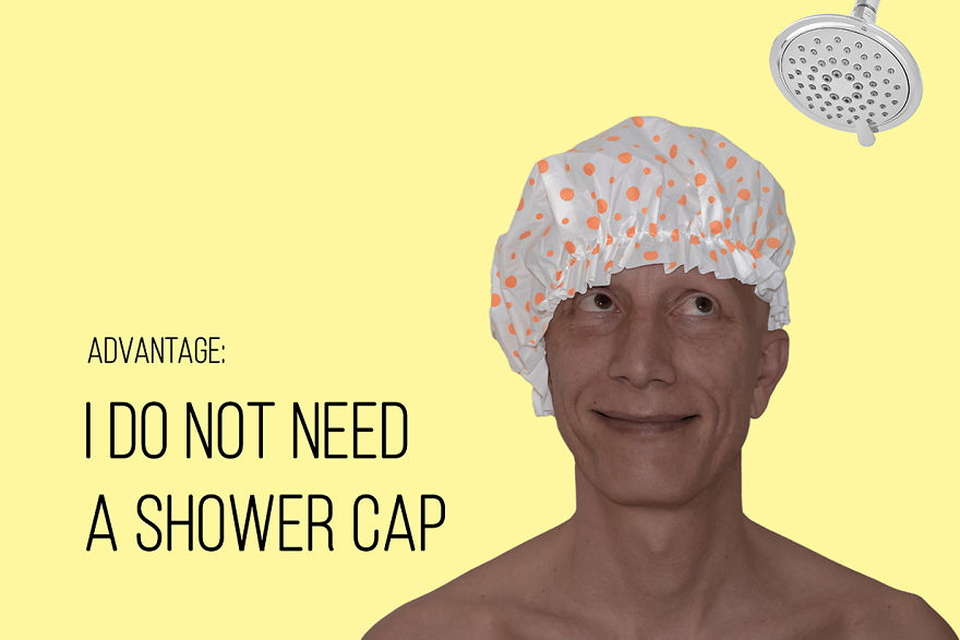 I've Been Living With Alopecia Universalis For 19 Years And I Show The Good And Bad Parts Of It (23 Pics)