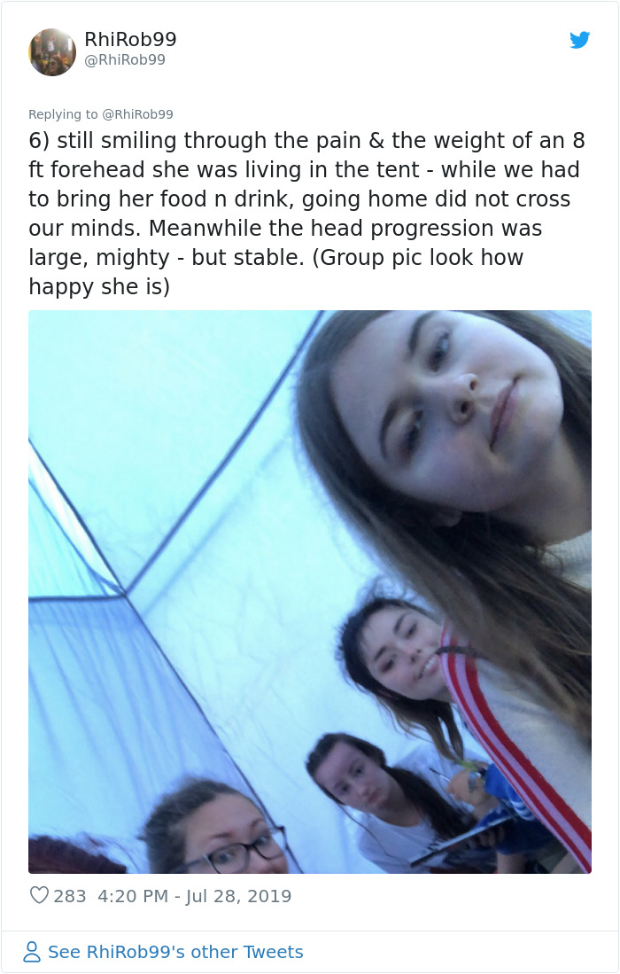 Girl Starts To Look Like An Alien Due To Swelling Head, Does Nothing Until Her Eyes Almost Swell Shut Girl Starts To Look Like An Alien Due To Swelling Head, Does Nothing Until Her Eyes Almost Swell Shut