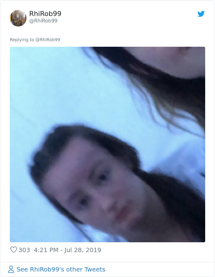 Girl Starts To Look Like An Alien Due To Swelling Head, Does Nothing Until Her Eyes Almost Swell Shut