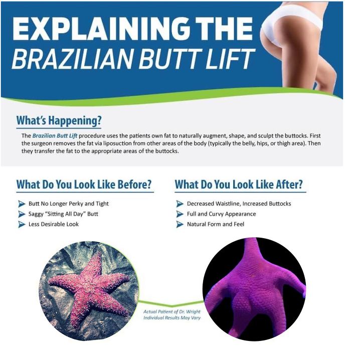 Patrick-Starfish-Photoshop-Battle