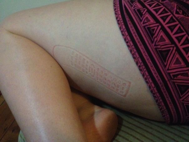 Found This On My Girlfriend's Butt