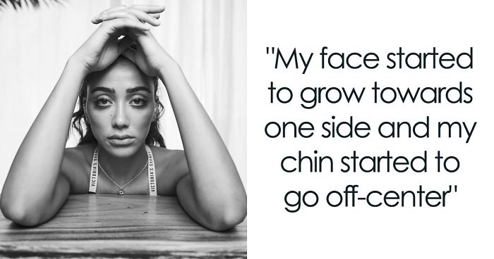 I Show Raw Pictures And Unedited Stories Of People And Their Body Insecurities (19 Pics)