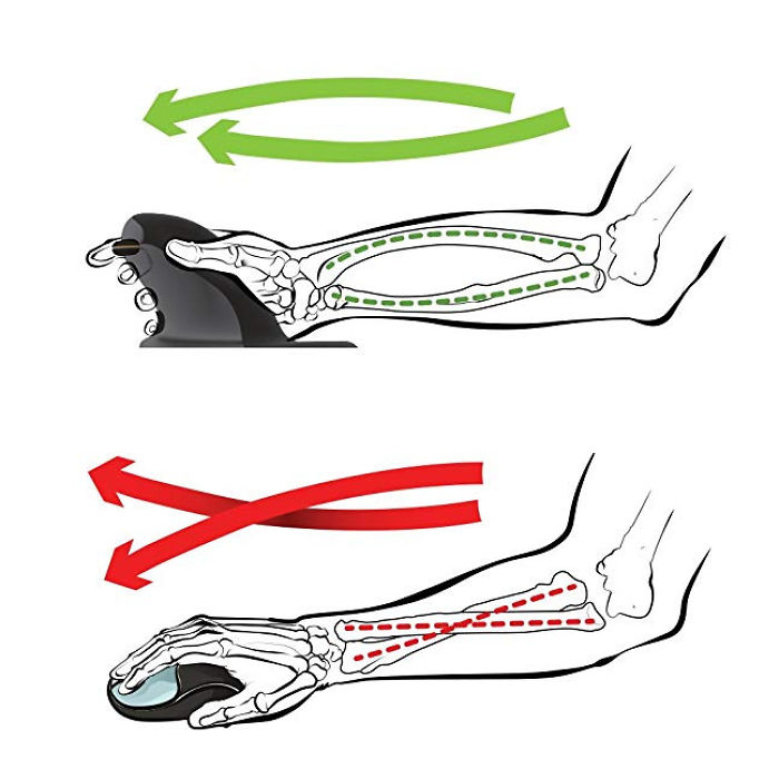 That's Not How Bones Work