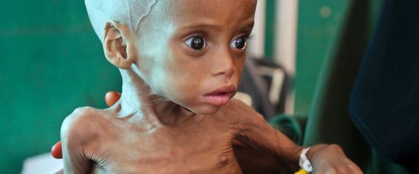 AP-Somalia-Drought3-MEM-170503_12x5_9921-5d231fa13b1b8.jpg
