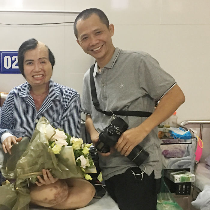 34-Year-Old Mother Survives Her Ex-Husband’s Acid Attack And I Want To Share Her Story 34-Year-Old Mother Survives Her Ex-Husband’s Acid Attack And I Want To Share Her Story