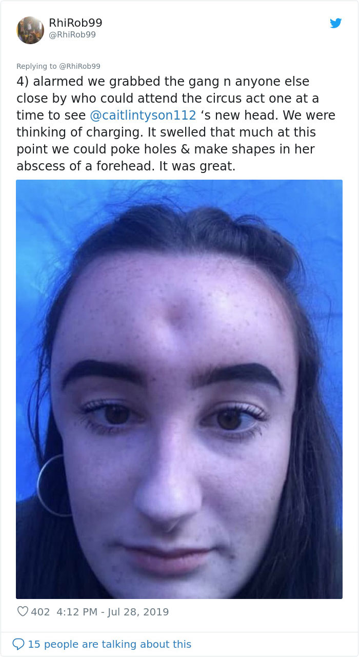 Girl Starts To Look Like An Alien Due To Swelling Head, Does Nothing Until Her Eyes Almost Swell Shut