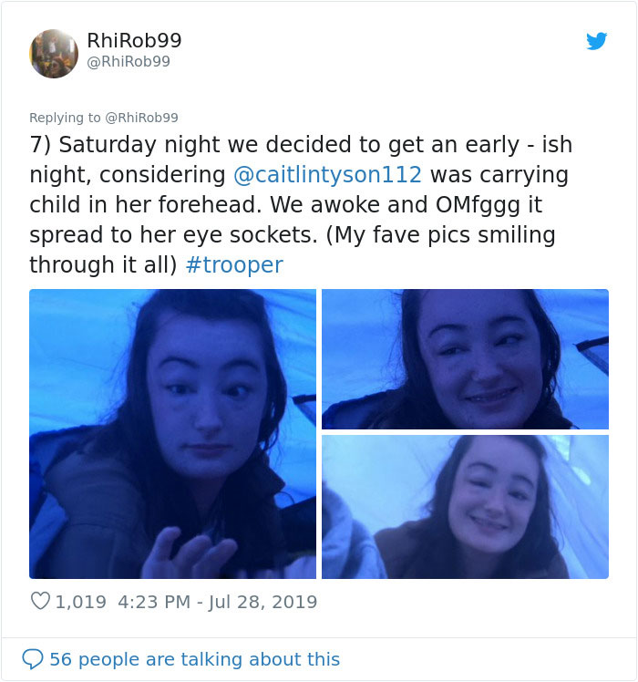 Girl Starts To Look Like An Alien Due To Swelling Head, Does Nothing Until Her Eyes Almost Swell Shut Girl Starts To Look Like An Alien Due To Swelling Head, Does Nothing Until Her Eyes Almost Swell Shut