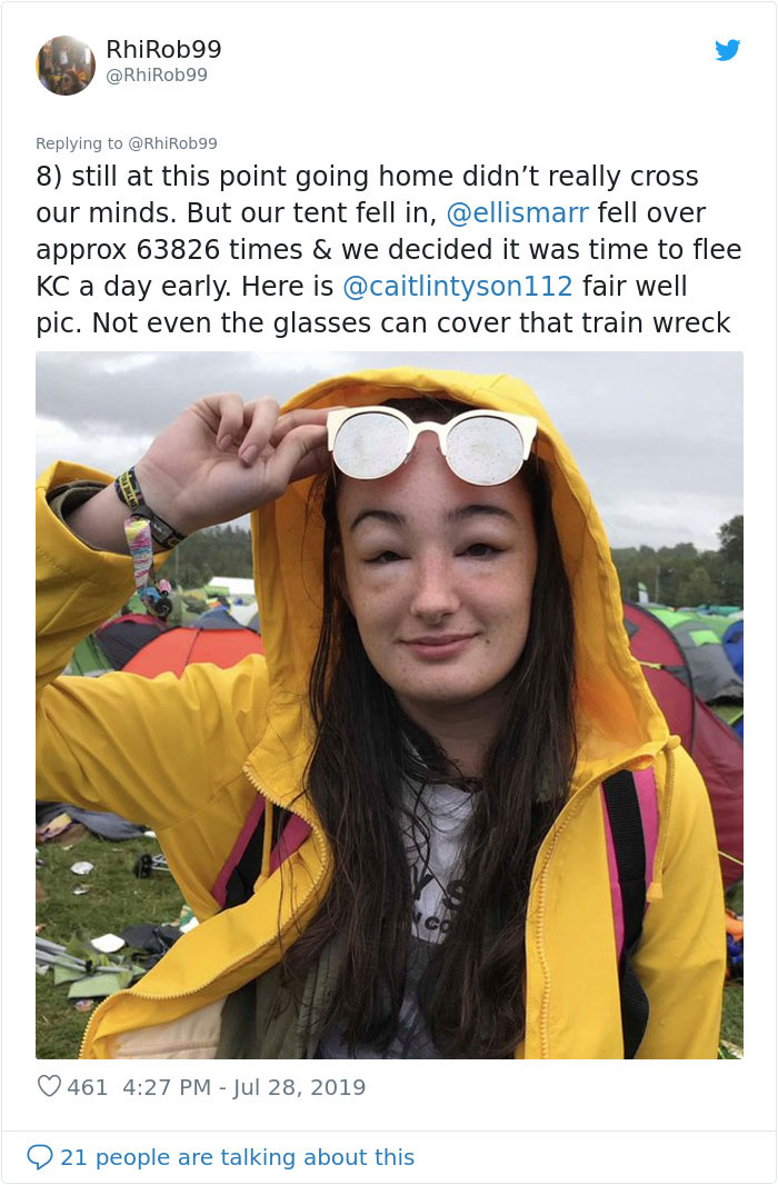 Girl Starts To Look Like An Alien Due To Swelling Head, Does Nothing Until Her Eyes Almost Swell Shut Girl Starts To Look Like An Alien Due To Swelling Head, Does Nothing Until Her Eyes Almost Swell Shut