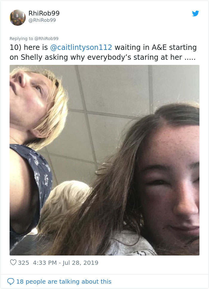 Girl Starts To Look Like An Alien Due To Swelling Head, Does Nothing Until Her Eyes Almost Swell Shut