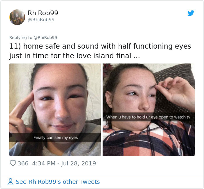Girl Starts To Look Like An Alien Due To Swelling Head, Does Nothing Until Her Eyes Almost Swell Shut