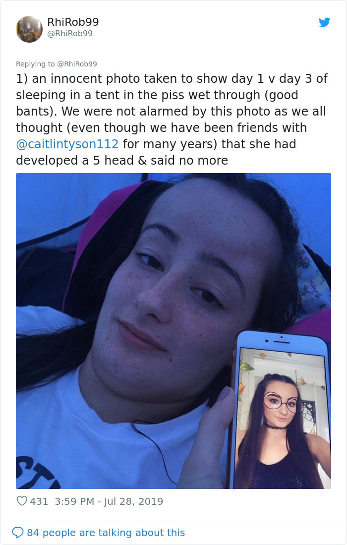 Girl Starts To Look Like An Alien Due To Swelling Head, Does Nothing Until Her Eyes Almost Swell Shut Girl Starts To Look Like An Alien Due To Swelling Head, Does Nothing Until Her Eyes Almost Swell Shut