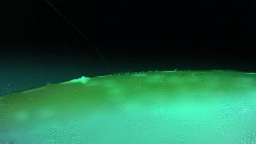 Elon Musk's Startup Creates Dystopian Brain Implant That Will Link Your Brain To A Computer Elon Musk's Startup Creates Dystopian Brain Implant That Will Link Your Brain To A Computer