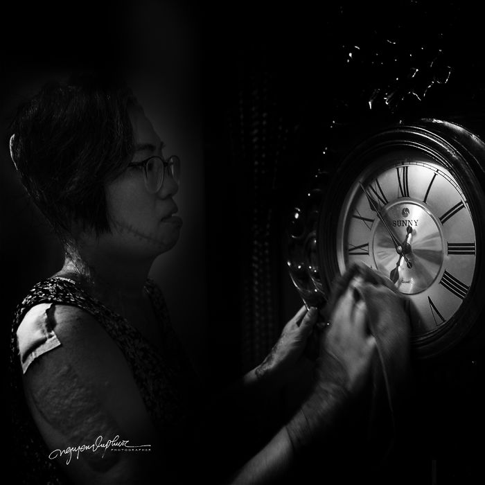 34-Year-Old Mother Survives Her Ex-Husband’s Acid Attack And I Want To Share Her Story 34-Year-Old Mother Survives Her Ex-Husband’s Acid Attack And I Want To Share Her Story