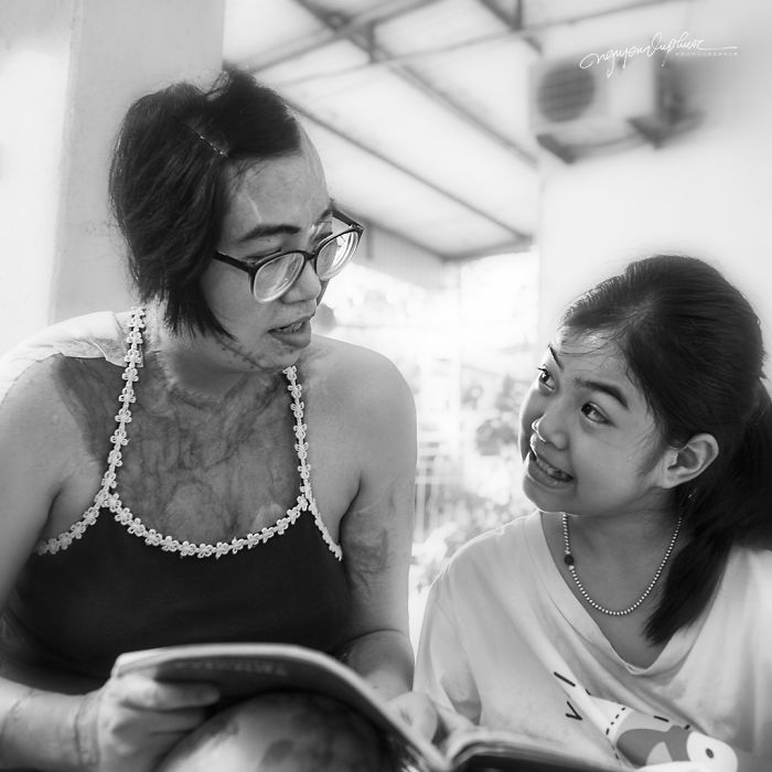 34-Year-Old Mother Survives Her Ex-Husband&rsquo;s Acid Attack And I Want To Share Her Story