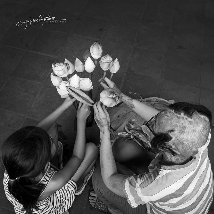 34-Year-Old Mother Survives Her Ex-Husband&rsquo;s Acid Attack And I Want To Share Her Story