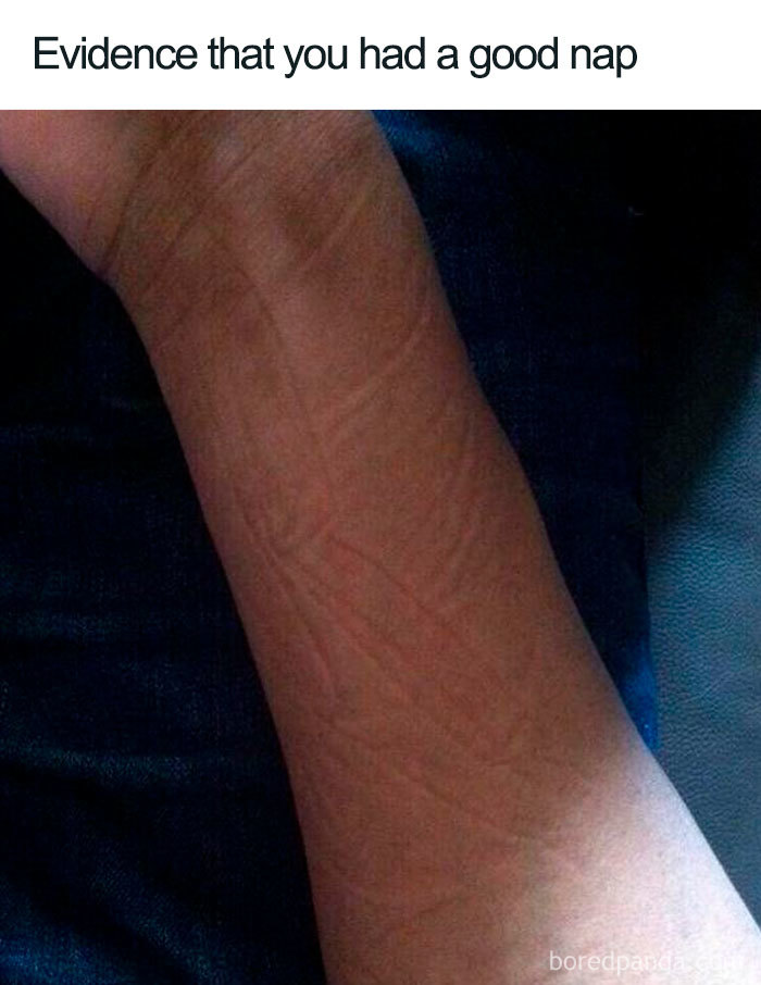Funny sleeping meme showing a forearm with creases, humorously captured as evidence of a good nap.