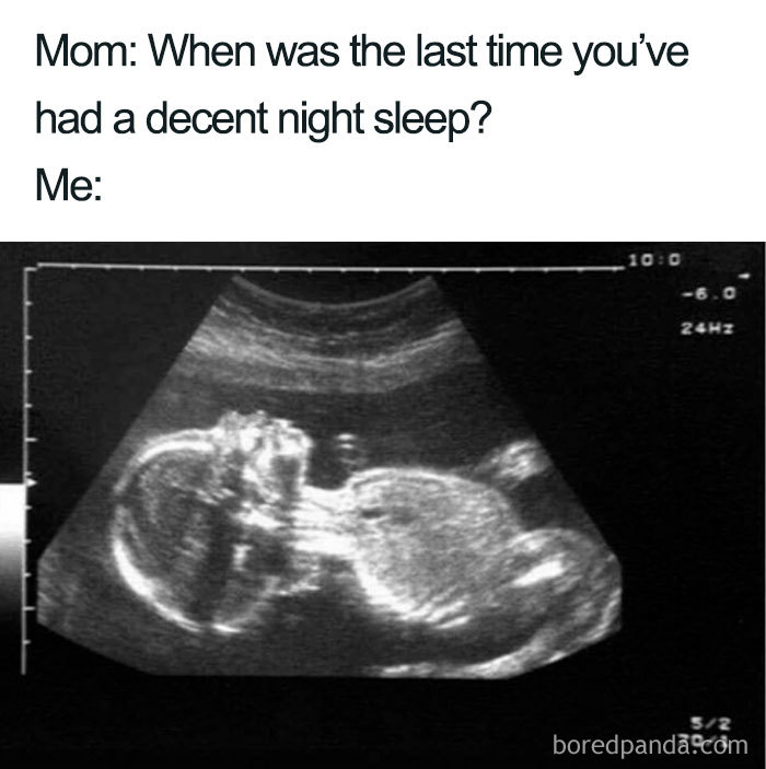 Ultrasound image humorously depicting sleeping memes with text about lack of sleep.